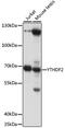 YTH N6-Methyladenosine RNA Binding Protein 2 antibody, 16-137, ProSci, Western Blot image 