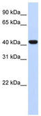 Forkhead Box D1 antibody, TA332095, Origene, Western Blot image 