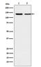 Exportin 5 antibody, M02900-1, Boster Biological Technology, Western Blot image 