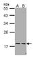 PEST Proteolytic Signal Containing Nuclear Protein antibody, NBP1-31692, Novus Biologicals, Western Blot image 