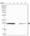 Ankyrin Repeat Domain 18A antibody, PA5-62367, Invitrogen Antibodies, Western Blot image 