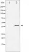Glycogen Synthase Kinase 3 Beta antibody, TA326008, Origene, Western Blot image 