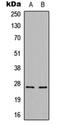 Cerebellin-3 antibody, orb304711, Biorbyt, Western Blot image 