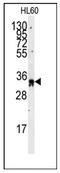 Exosome Component 8 antibody, AP12431PU-N, Origene, Western Blot image 