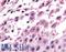 Discoidin Domain Receptor Tyrosine Kinase 1 antibody, LS-A2853, Lifespan Biosciences, Immunohistochemistry frozen image 