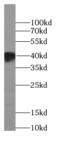 Bardet-Biedl Syndrome 5 antibody, FNab00820, FineTest, Western Blot image 