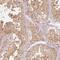 UBE2L3 antibody, HPA062415, Atlas Antibodies, Immunohistochemistry frozen image 