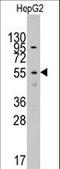 Leucine Aminopeptidase 3 antibody, LS-C100880, Lifespan Biosciences, Western Blot image 