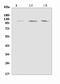Echinoderm microtubule-associated protein-like 4 antibody, A00930-1, Boster Biological Technology, Western Blot image 