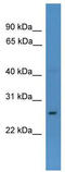Homeobox protein CDX-1 antibody, TA335206, Origene, Western Blot image 
