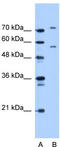 Junctophilin 1 antibody, TA338427, Origene, Western Blot image 