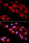 Catenin Delta 1 antibody, orb48338, Biorbyt, Immunofluorescence image 