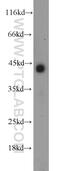 Interleukin 10 Receptor Subunit Beta antibody, 15102-1-AP, Proteintech Group, Western Blot image 