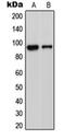 Disintegrin and metalloproteinase domain-containing protein 23 antibody, orb214827, Biorbyt, Western Blot image 