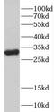 Dolichyl-Phosphate Mannosyltransferase Subunit 1, Catalytic antibody, FNab02518, FineTest, Western Blot image 