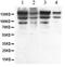 Double-stranded RNA-specific adenosine deaminase antibody, PA5-78729, Invitrogen Antibodies, Western Blot image 