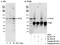 TPX2 Microtubule Nucleation Factor antibody, A300-430A, Bethyl Labs, Immunoprecipitation image 