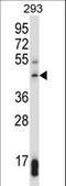 Histone-lysine N-methyltransferase SUV39H1 antibody, LS-C161628, Lifespan Biosciences, Western Blot image 