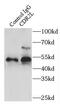 Cerebellar degeneration-related protein 2-like antibody, FNab01569, FineTest, Immunoprecipitation image 