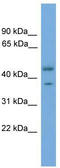 Phosphoribosyl Pyrophosphate Synthetase Associated Protein 2 antibody, TA342156, Origene, Western Blot image 