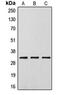 Distal-Less Homeobox 5 antibody, orb213853, Biorbyt, Western Blot image 