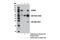 UV Radiation Resistance Associated antibody, 13115S, Cell Signaling Technology, Immunoprecipitation image 