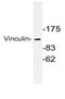 Vinculin antibody, AP06605PU-N, Origene, Western Blot image 