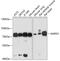 Adenosine Monophosphate Deaminase 1 antibody, 19-094, ProSci, Western Blot image 