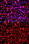 Chitobiosyldiphosphodolichol beta-mannosyltransferase antibody, GTX64746, GeneTex, Immunocytochemistry image 
