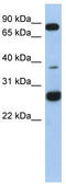 Coiled-Coil Domain Containing 190 antibody, TA333427, Origene, Western Blot image 
