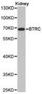 Beta-Transducin Repeat Containing E3 Ubiquitin Protein Ligase antibody, A01747, Boster Biological Technology, Western Blot image 