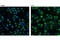 Leucyl And Cystinyl Aminopeptidase antibody, 9876S, Cell Signaling Technology, Immunofluorescence image 