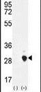 Chorionic somatomammotropin hormone antibody, PA5-24412, Invitrogen Antibodies, Western Blot image 