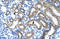 Histone-lysine N-methyltransferase SUV420H1 antibody, orb324573, Biorbyt, Immunohistochemistry paraffin image 