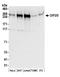 Disco Interacting Protein 2 Homolog B antibody, A304-638A, Bethyl Labs, Western Blot image 