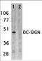 CD209 antibody, 2349, ProSci, Western Blot image 