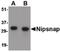 Protein NipSnap homolog 1 antibody, PA5-20501, Invitrogen Antibodies, Western Blot image 