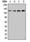 Mitotic checkpoint serine/threonine-protein kinase BUB1 antibody, LS-C668132, Lifespan Biosciences, Western Blot image 