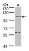 Zinc finger protein Rlf antibody, NBP1-33086, Novus Biologicals, Western Blot image 