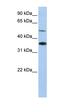 Rh Family B Glycoprotein (Gene/Pseudogene) antibody, orb330590, Biorbyt, Western Blot image 