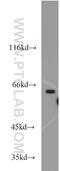 Aprataxin And PNKP Like Factor antibody, 14252-1-AP, Proteintech Group, Western Blot image 
