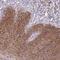 Ribosomal Protein S3 antibody, HPA063339, Atlas Antibodies, Immunohistochemistry frozen image 