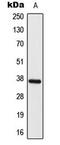 ELOVL Fatty Acid Elongase 4 antibody, GTX55225, GeneTex, Western Blot image 
