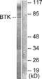 Bruton Tyrosine Kinase antibody, LS-C117550, Lifespan Biosciences, Western Blot image 