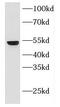 Keratin 18 antibody, FNab02204, FineTest, Western Blot image 