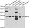 APAF1 Interacting Protein antibody, A7102, ABclonal Technology, Western Blot image 