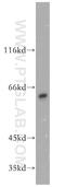 Drp3 antibody, 13661-1-AP, Proteintech Group, Western Blot image 