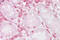 p67 antibody, ARP52266_P050, Aviva Systems Biology, Immunohistochemistry paraffin image 