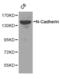 CDH2 antibody, TA326835, Origene, Western Blot image 