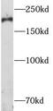 RB1 Inducible Coiled-Coil 1 antibody, FNab07143, FineTest, Western Blot image 
